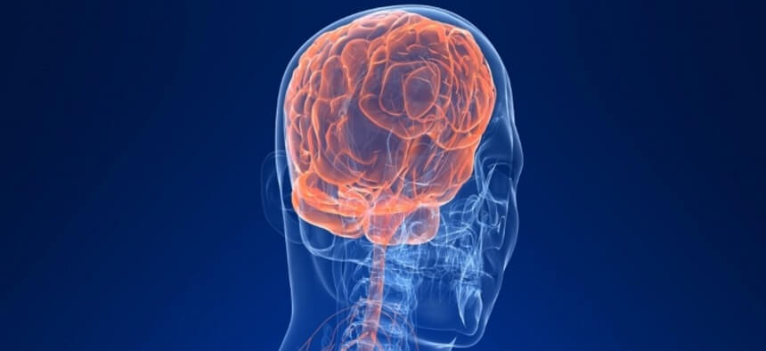 Neurointerventional Radiology Surgery in Pune